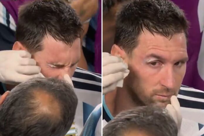 Qué le pasó en el ojo a Lionel Messi frente a Suiza: codazo y atención médica