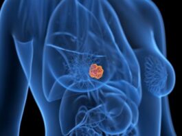 Cáncer de mama: cuál es el estudio que las mujeres de 40 años o más deberían realizarse